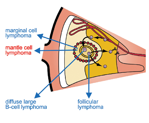 Mantle Cell Lymphoma An image showing where mantle cell lymphoma is located