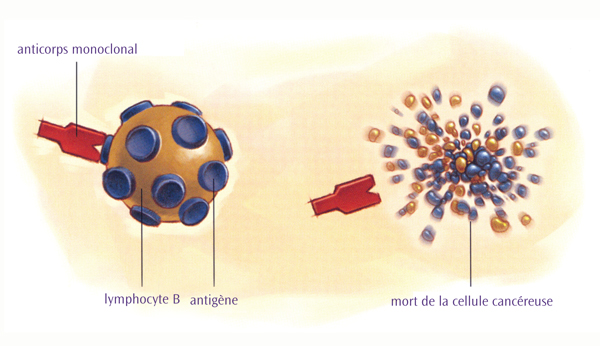 Traitement par anticorps monoclonal Traitement par anticorps monoclonal